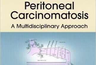 free-pdf-download-Peritoneal Carcinomatosis: A Multidisciplinary Approach (Cancer Treatment and Research)