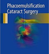 free-pdf-download-Phacoemulsification Cataract Surgery 1st ed. 2017 Edition