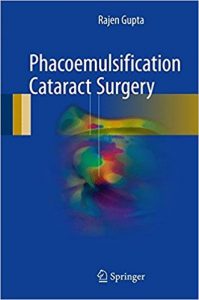 free-pdf-download-Phacoemulsification Cataract Surgery 1st ed. 2017 Edition