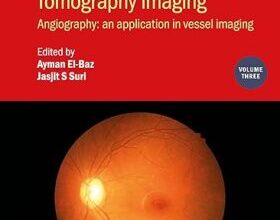 free-pdf-download-Photo Acoustic and Optical Coherence Tomography Imaging: Angiography: – An Application in Vessel Imaging (Volume 3)