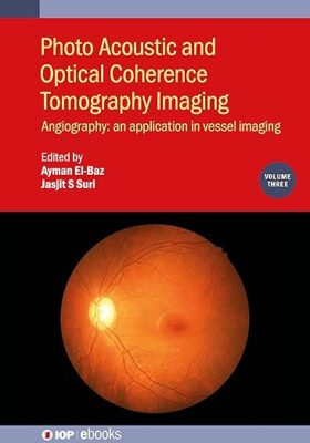 free-pdf-download-Photo Acoustic and Optical Coherence Tomography Imaging: Angiography: – An Application in Vessel Imaging (Volume 3)