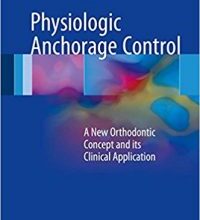 free-pdf-download-Physiologic Anchorage Control: A New Orthodontic Concept and its Clinical Application 1st ed. 2017 Edition