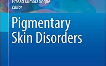 free-pdf-download-Pigmentary Skin Disorders (Updates in Clinical Dermatology) 1st ed. 2018 Edition