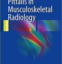 free-pdf-download-Pitfalls in Musculoskeletal Radiology 1st ed. 2017 Edition