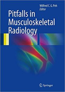 free-pdf-download-Pitfalls in Musculoskeletal Radiology 1st ed. 2017 Edition