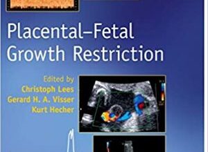 free-pdf-download-Placental-Fetal Growth Restriction 1st Edition