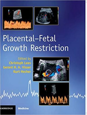 free-pdf-download-Placental-Fetal Growth Restriction 1st Edition