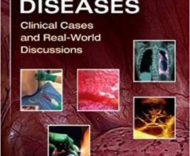 free-pdf-download-Pleural Diseases: Clinical Cases and Real-World Discussions