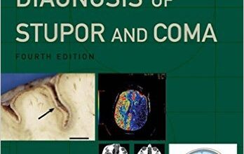 free-pdf-download-Plum and Posner’s Diagnosis of Stupor and Coma (Contemporary Neurology Series) 4th Edition