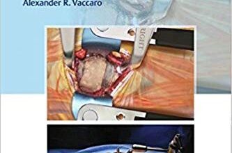 free-pdf-download-Pocket Atlas of Spine Surgery 2nd Edition