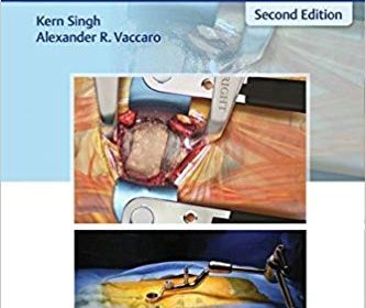 free-pdf-download-Pocket Atlas of Spine Surgery 2nd Edition