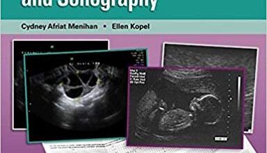 free-pdf-download-Point-of-Care Assessment in Pregnancy and Women’s Health: Electronic Fetal Monitoring and Sonography