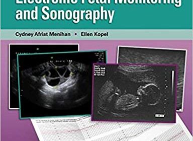 free-pdf-download-Point-of-Care Assessment in Pregnancy and Women’s Health: Electronic Fetal Monitoring and Sonography Pap/Psc Edition