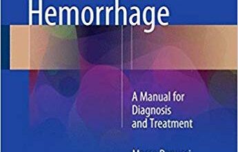 free-pdf-download-Point-of-Care Tests for Severe Hemorrhage: A Manual for Diagnosis and Treatment 1st ed