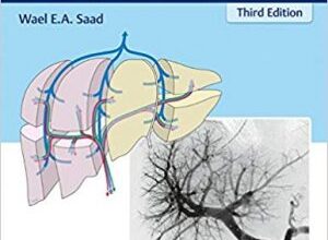 free-pdf-download-Portal Hypertension: Imaging