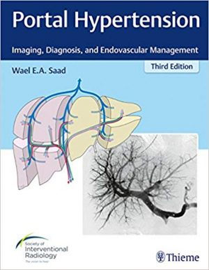 free-pdf-download-Portal Hypertension: Imaging