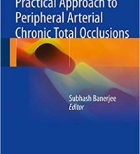 free-pdf-download-Practical Approach to Peripheral Arterial Chronic Total Occlusions 1st ed. 2017 Edition