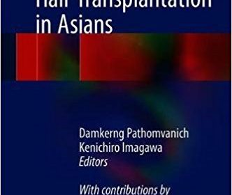 free-pdf-download-Practical Aspects of Hair Transplantation in Asians 1st ed. 2018 Edition