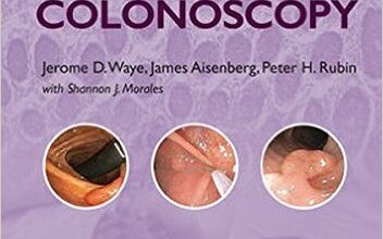 free-pdf-download-Practical Colonoscopy 1st Edition