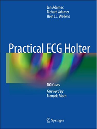 free-pdf-download-Practical ECG Holter: 100 Cases 2012th Edition