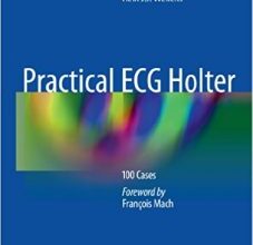 free-pdf-download-Practical ECG Holter: 100 Cases