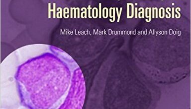 free-pdf-download-Practical Flow Cytometry in Haematology Diagnosis 1st Edition