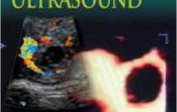 free-pdf-download-Practical Guide to Emergency Ultrasound 1st Edition