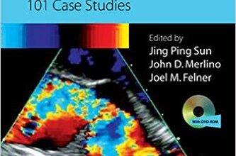 free-pdf-download-Practical Handbook of Echocardiography: 101 Case Studies 1st Edition