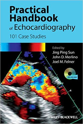 free-pdf-download-Practical Handbook of Echocardiography: 101 Case Studies 1st Edition