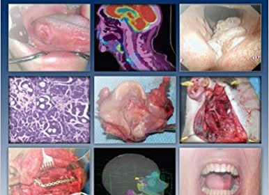 free-pdf-download-Practical Head and Neck Oncology