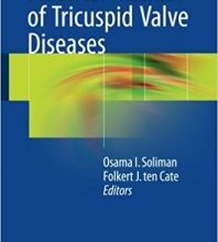 free-pdf-download-Practical Manual of Tricuspid Valve Diseases 1st ed. 2018 Edition