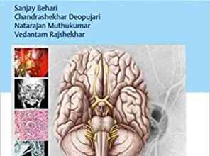 free-pdf-download-Practical Neurosurgery