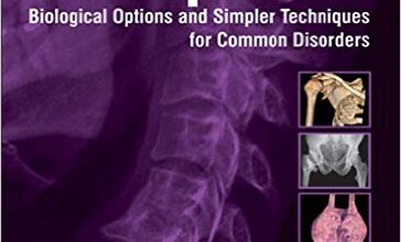 free-pdf-download-Practical Orthopedics Biological Options and Simpler Techniques for Common Disorders