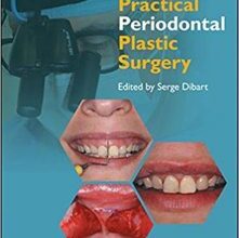 free-pdf-download-Practical Periodontal Plastic Surgery 2nd Edition