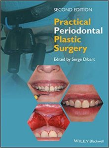 free-pdf-download-Practical Periodontal Plastic Surgery 2nd Edition