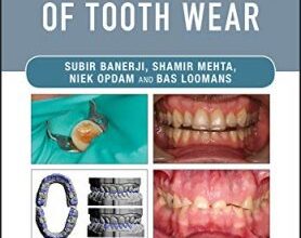 free-pdf-download-Practical Procedures in the Management of Tooth Wear