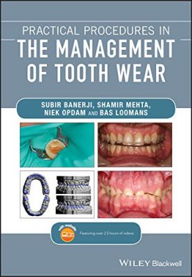 free-pdf-download-Practical Procedures in the Management of Tooth Wear