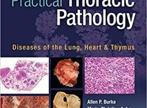 free-pdf-download-Practical Thoracic Pathology: Diseases of the Lung