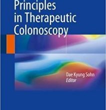 free-pdf-download-Practice and Principles in Therapeutic Colonoscopy 1st ed. 2018 Edition