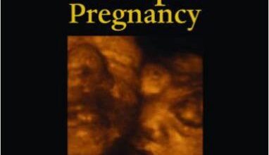 free-pdf-download-Prenatal Assessment of Multiple Pregnancy