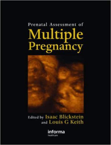 free-pdf-download-Prenatal Assessment of Multiple Pregnancy