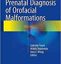 free-pdf-download-Prenatal Diagnosis of Orofacial Malformations 1st ed. 2017 Edition