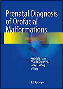 free-pdf-download-Prenatal Diagnosis of Orofacial Malformations 1st ed. 2017 Edition