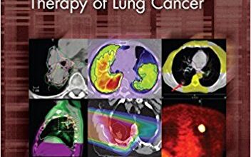 free-pdf-download-Principles and Practice of Image-Guided Radiation Therapy of Lung Cancer (Imaging in Medical Diagnosis and Therapy) 1st Edition