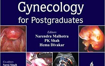 free-pdf-download-Principles and Practice of Obstetrics and Gynecology for Postgraduates