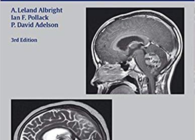 free-pdf-download-Principles and Practice of Pediatric Neurosurgery 3rd Edition