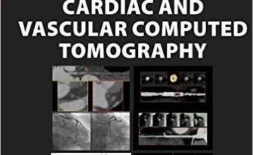 free-pdf-download-Principles of Cardiac and Vascular Computed Tomography