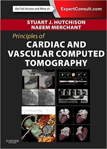 free-pdf-download-Principles of Cardiac and Vascular Computed Tomography