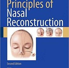 free-pdf-download-Principles of Nasal Reconstruction 2nd ed