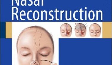 free-pdf-download-Principles of Nasal Reconstruction 2nd ed. 2011 Edition